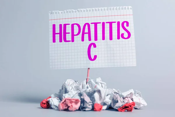 C型肝炎を示す記号 ウイルス感染による肝臓の炎症を意味する概念肝臓病 — ストック写真
