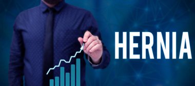 Kavramsal başlık fıtık, dokuların anormal çıkışı üzerine yazılmış bir kelime veya boşluğun duvarından geçen bir organ.