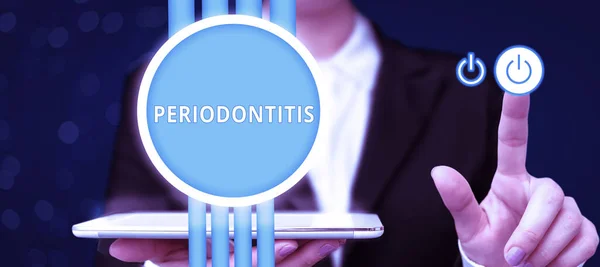 Pisanie Wyświetlania Tekstu Periodontitis Business Showcase Obrzęk Tkanki Wokół Zębów — Zdjęcie stockowe