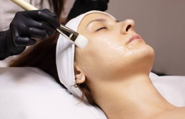 Kozmetik güzellik prosedürü. Genç kadın cilt bakımı. Yenilenme tedavisi. Yüz kimyasal soyma terapisi..             