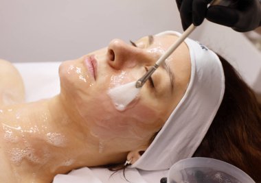 Kozmetik güzellik prosedürü. Genç kadın cilt bakımı. Yenilenme tedavisi. Yüz kimyasal soyma terapisi..             