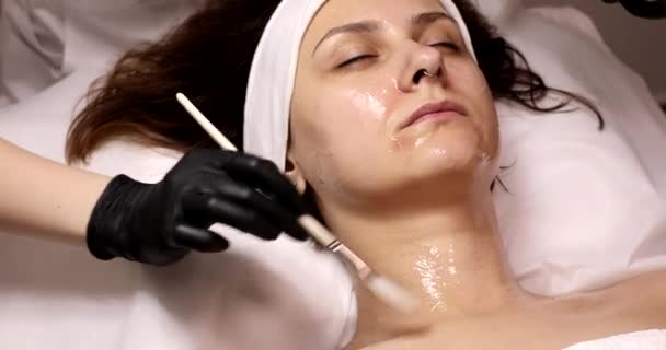 Процедура Косметології Краси Догляд Шкірою Молодої Жінки Лікування Омолодження Хімічна — стокове відео