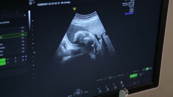 Kyiv Ukraine January 2022 Ultrasound Examination Fetus Pregnant Woman Ultrasonic — стоковое видео