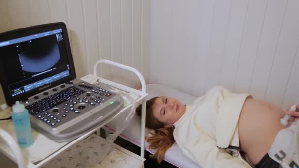 Kyiv Ukraine January 2022 Ultrasound Examination Fetus Pregnant Woman Apparatus — Wideo stockowe