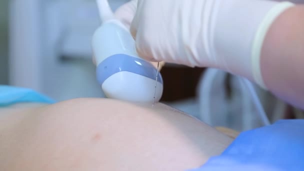 Amniocentesis Amniotic Fluid Test Ultrasound Examination Fetus Pregnant Woman Ultrasonic — 图库视频影像