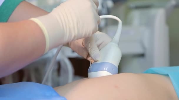 Kyiv Ukraine February 2022 Amniocentesis Amniotic Fluid Test Ultrasound Examination — Vídeos de Stock