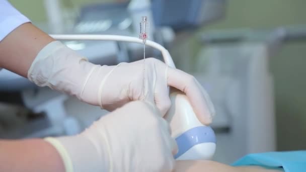Kyiv Ukraine February 2022 Amniocentesis Amniotic Fluid Test Ultrasound Examination — Video