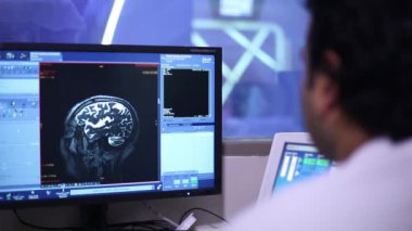 Beyin tomografisi. Doktor beyin tomografisi sonuçlarını inceliyor..