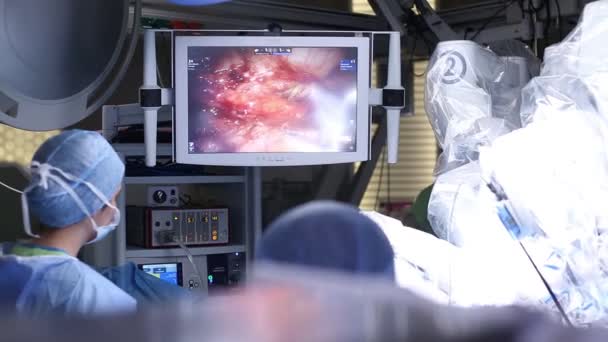 Istanbul Turkey Μαρτίου 2017 Στο Χειρουργείο Ρομποτικής Χειρουργικής Ένα Ρομπότ — Αρχείο Βίντεο