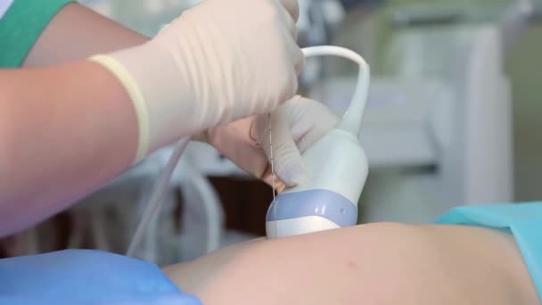 Amniocentesis Prueba Líquido Amniótico Examen Ecográfico Del Feto Una Mujer — Vídeo de stock