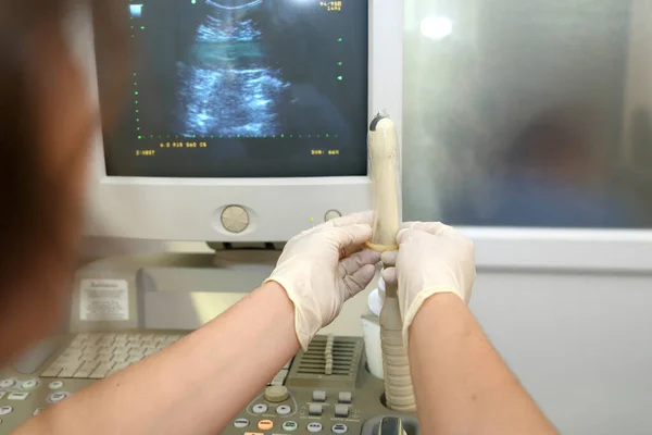 Quiv Ucrânia Junho 2022 Exame Ultrassom Vaginal Uma Mulher Ginecologista — Fotografia de Stock