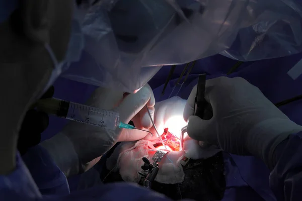 Treatment Brain Aneurysm Surgical Operation Brain Team Surgeons Performing Brain — Stock Photo, Image