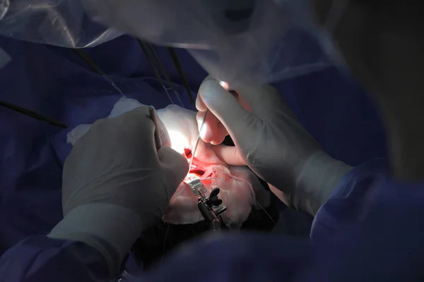 Tratamento Aneurisma Cerebral Operação Cirúrgica Cérebro Uma Equipe Cirurgiões Realizando — Fotografia de Stock