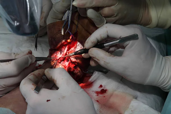 缝合手腕的手术 神经外科医生和创伤学家团队恢复了手部 手术缝合手腕上的神经和肌腱 — 图库照片