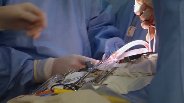 Een Open Hartoperatie Hartoperatie Harttransplantatie Van Een Donor — Stockvideo