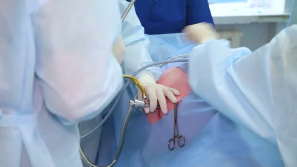 Chirurgen Team Handen Tijdens Laparoscopische Abdominale Operatie Werking Met Endoscopische — Stockvideo