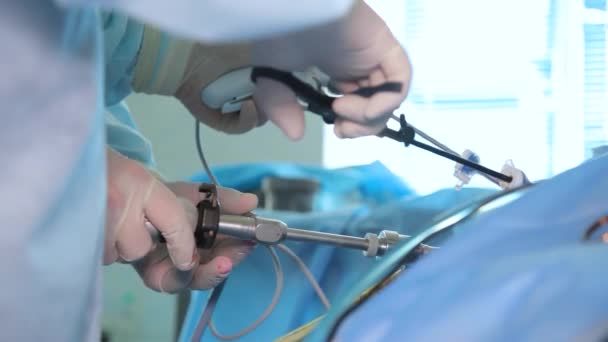 Cerrahlar Laparoskopik Karın Ameliyatı Sırasında Ele Tutuşur Endoskopik Ekipman Kullanarak — Stok video