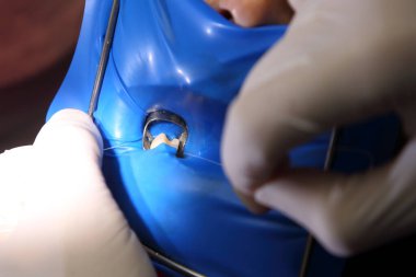 Diş hekimliği. Dişçinin işyeri. Klinikteki dişçiyi ziyaret eden genç bir kadın. Klinikte hastası olan bir erkek dişçi..