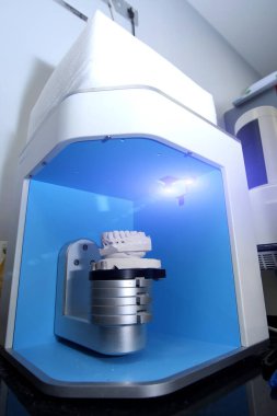 Diş kaplamaları ve seramiklerden yapılmış takma dişler. Alçı diş kalıplarının taranması. Diş kliniğinde seramik protez üretimi. İmplantlar için seramik diş başlıkları.