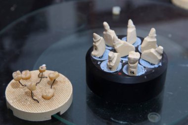 Diş kaplamaları ve seramiklerden yapılmış takma dişler. Alçı diş kalıplarının taranması. Diş kliniğinde seramik protez üretimi. İmplantlar için seramik diş başlıkları.