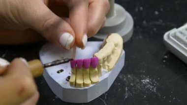 Diş teknisyeni diş kaplaması ve protez kalıpları üzerinde çalışıyor. Diş kliniğinde seramik protez üretimi. İmplantlar için seramik diş başlıkları. 