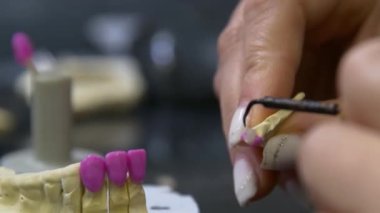 Diş teknisyeni diş kaplaması ve protez kalıpları üzerinde çalışıyor. Diş kliniğinde seramik protez üretimi. İmplantlar için seramik diş başlıkları. 