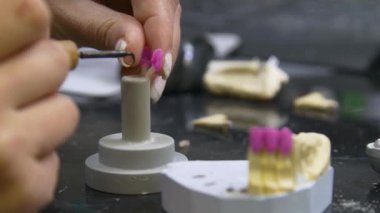 Diş teknisyeni diş kaplaması ve protez kalıpları üzerinde çalışıyor. Diş kliniğinde seramik protez üretimi. İmplantlar için seramik diş başlıkları. 