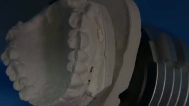 Takma diş üretimi için 3 boyutlu tarayıcıdaki kalıpların taranması. Diş kliniğinde seramik protez üretimi. İmplantlar için seramik diş başlıkları.