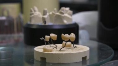 Diş teknisyeni diş kaplaması ve protez kalıpları üzerinde çalışıyor. Diş kliniğinde seramik protez üretimi. İmplantlar için seramik diş başlıkları. 