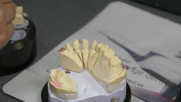 Diş Teknisyeni Diş Kaplaması Protez Kalıpları Üzerinde Çalışıyor Diş Kliniğinde — Stok video