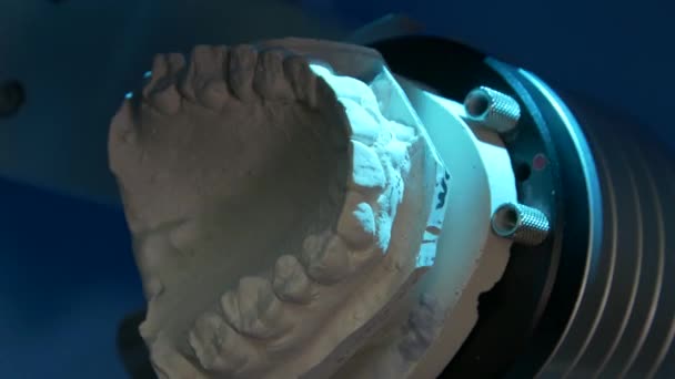 Escaneo Moldes Escáner Para Fabricación Dentaduras Postizas Fabricación Prótesis Dentales — Vídeos de Stock