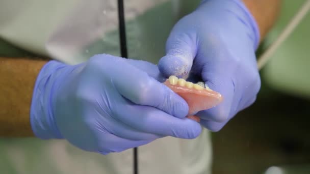 用陶瓷制成的牙冠和假牙 扫描牙膏铸件 在牙科诊所制造陶瓷假牙 植入物用陶瓷牙冠 — 图库视频影像