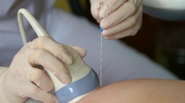 Amniyotik sıvı testi. Amniyosentez. Hamile bir kadının cenininin ultrason muayenesi. Ultrasonik tarayıcı.