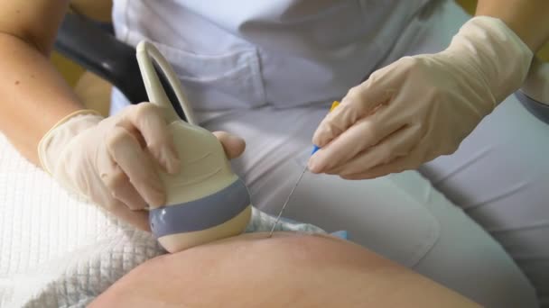 Test Płynu Owodniowego Amniopunkcja Badanie Ultrasonograficzne Płodu Ciężarnej Kobiety Skaner — Wideo stockowe
