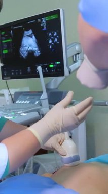 KYIV, UKRAINE - 19 Mart 2024: Amniyotik sıvı testi. Amniyosentez. Hamile bir kadının cenininin ultrason muayenesi. Ultrasonik tarayıcı. Dikey video