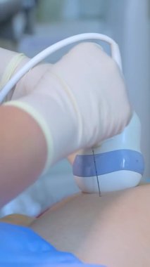 Amniyotik sıvı testi. Amniyosentez. Hamile bir kadının cenininin ultrason muayenesi. Ultrasonik tarayıcı. Dikey video.