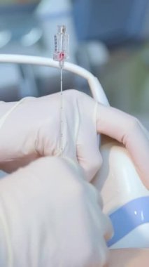 Amniyotik sıvı testi. Amniyosentez. Hamile bir kadının cenininin ultrason muayenesi. Ultrasonik tarayıcı. Dikey video.