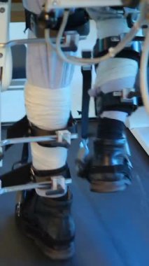 Lokomat yürüyüş rehabilitasyon robotu. Yürüyen tıbbi robot. Yürüyen tıbbi robot felç ve beyin felci tedavisinde kullanılır..
