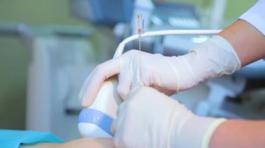 Amniyotik sıvı testi. Amniyosentez. Hamile bir kadının cenininin ultrason muayenesi.. 