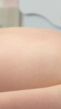 Gelişmiş masaj teknolojileri. Lazer masaj aleti. Masaj. Dikey video.