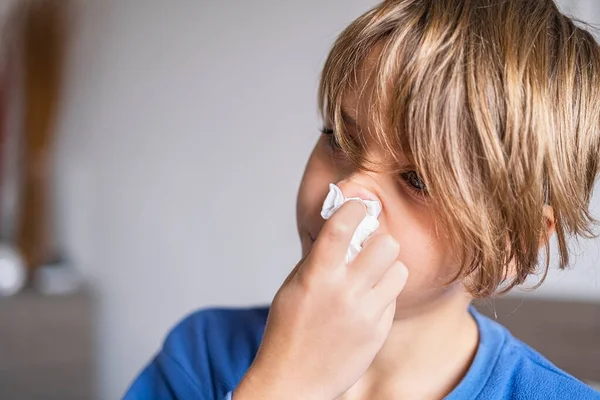 Little child boy blow his nose. Allergic kid, flu season. Kid with cold rhinitis, get cold snot nose. virus and infection