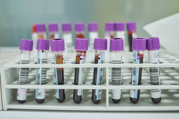 Modern Laboratuardaki Masaya Koyulmuş Koyu Kırmızı Kan Test Tüpleri — Stok fotoğraf