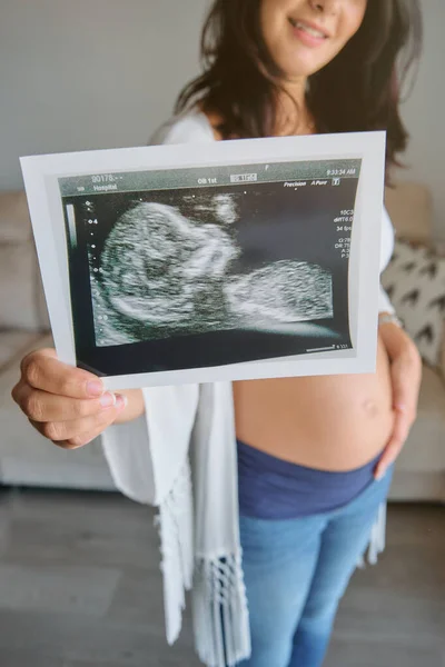 Těhotná Žena Bez Tváře Demonstrující Ultrazvukový Snímek Plodu Ruce Když — Stock fotografie