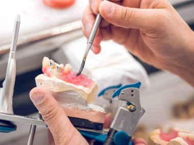 Laboratuvarda çalışırken paslanmaz çelikten yapılmış diş spatulasını kullanarak takma dişleri ağdaya takan isimsiz erkek ortodontistin tepesinden.