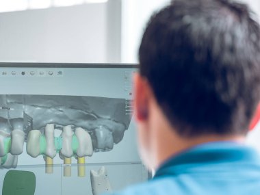 Modern laboratuarda çalışırken diş protezinin 3 boyutlu sanal modelini inceleyen isimsiz erkek uzmanların arka plandaki görüntüsü