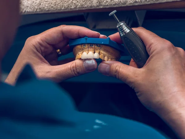 上記の作物から 匿名の男性専門の粉砕偽の陶磁器の歯は 研究室で入れ歯を作っている間投げられた — ストック写真