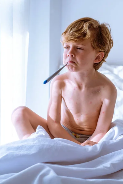 Nemocný Chlapec Bez Trička Neštovicemi Puchýři Odvracející Pohled Držící Digitální — Stock fotografie