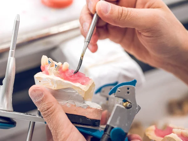 Crop Anonymous Male Orthodontist Setting Denture Wax Using Dental Spatula — Stock Photo, Image