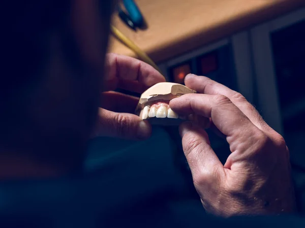 실험실에서 세라믹 치아로 보철물을 검사하는 기술자의 위에서 — 스톡 사진