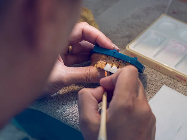 Crop Male Orthodontist Putting Ceramic Brush Denture While Making Jaw — Stock Photo, Image